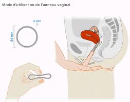 anneau vaginal