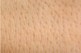 La peau La peau